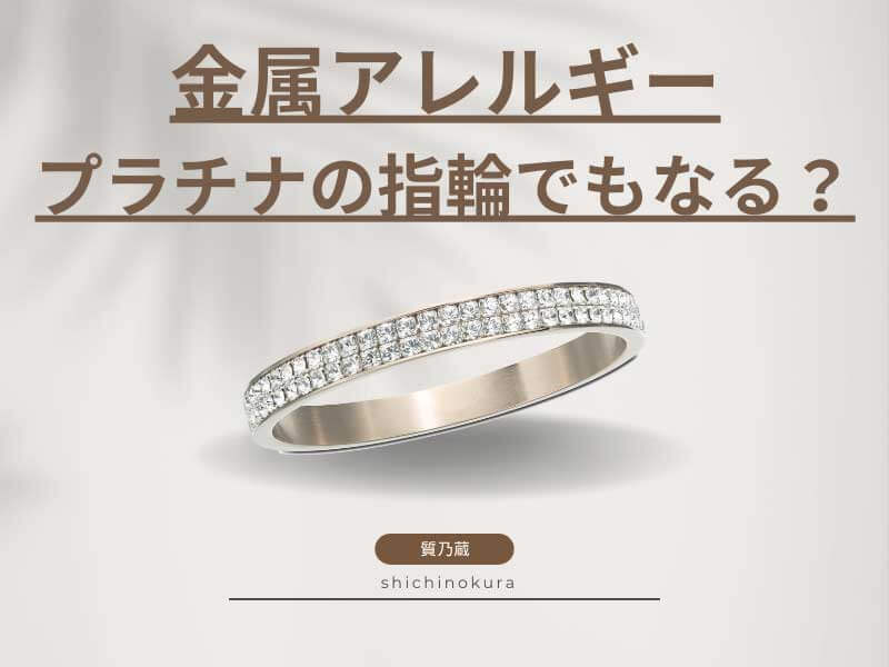金属アレルギーはプラチナの指輪でもなる？